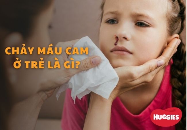 Chảy máu cam ở trẻ là gì?