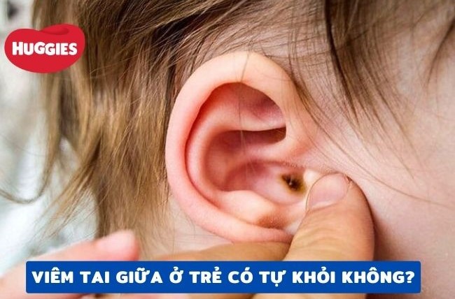 Viêm tai giữa ở trẻ có tự khỏi không?