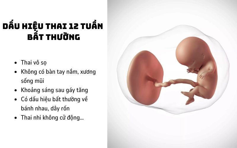 Dấu hiệu thai 12 tuần bất thường