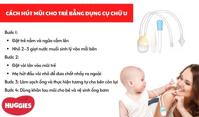 Cách hút mũi cho trẻ bằng dụng cụ chữ U 