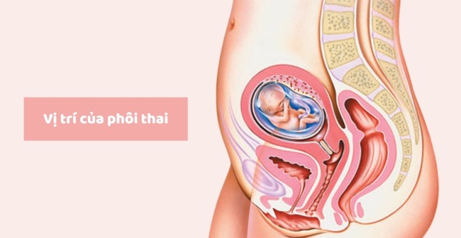 Phôi thai nằm ở đâu?