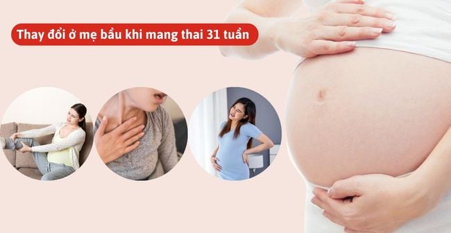 Ở tuần 31 thai kỳ, mẹ bầu thường cảm thấy khó thở, chuột rút, đau lưng