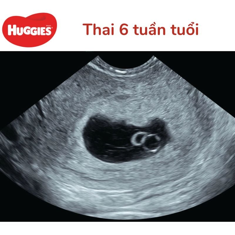 Những thay đổi của thai nhi tuần thứ 6